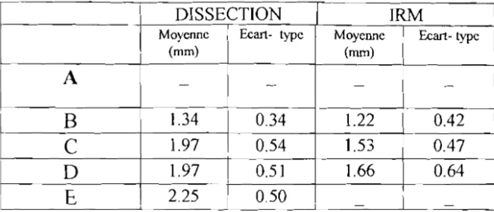 Tableau VI : Moyennes et écart - types des épaisseurs des radiations optiques.