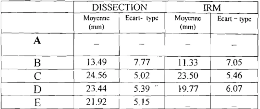 Tableau VII : Moyennes et écart - types des hauteurs des Radiations optiques.