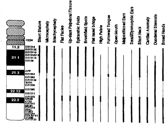 Figure n O S.1 : Carte phénotypique de la trisomie 21 avec les caractéristiques associées d'après Korenberg et al