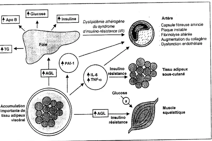 Figure 5: Contribution de l'obésité viscérale au  développement d'un  profil athéro- athéro-thrombogène pro-inflammatoire dans le syndrome métabolique [Despres 2000] 
