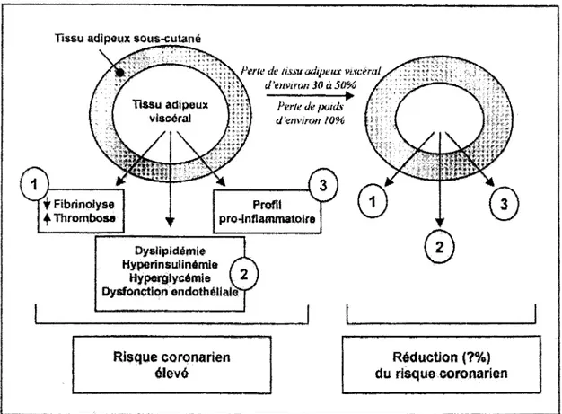 Figure 6: Modèle hypothétique de  réduction des  effets de  l'insulinorésistance [Despres  2000] 