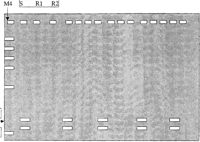 Figure 5 bis: schéma du gel de révélation des mutations du gène DHFR après digestion enzymatique