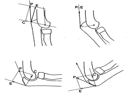 Figure 12 : Action des muscles extenseurs du coude  (d’après Fischer (11) )