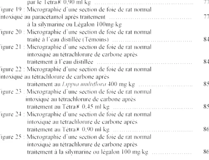 Figure  19  . Mierographie'  cI'ulle  ~ectioll  de  t\.He  de  rat  normal  intoxiqué  au  paraeétamol  après traitemellt  .....
