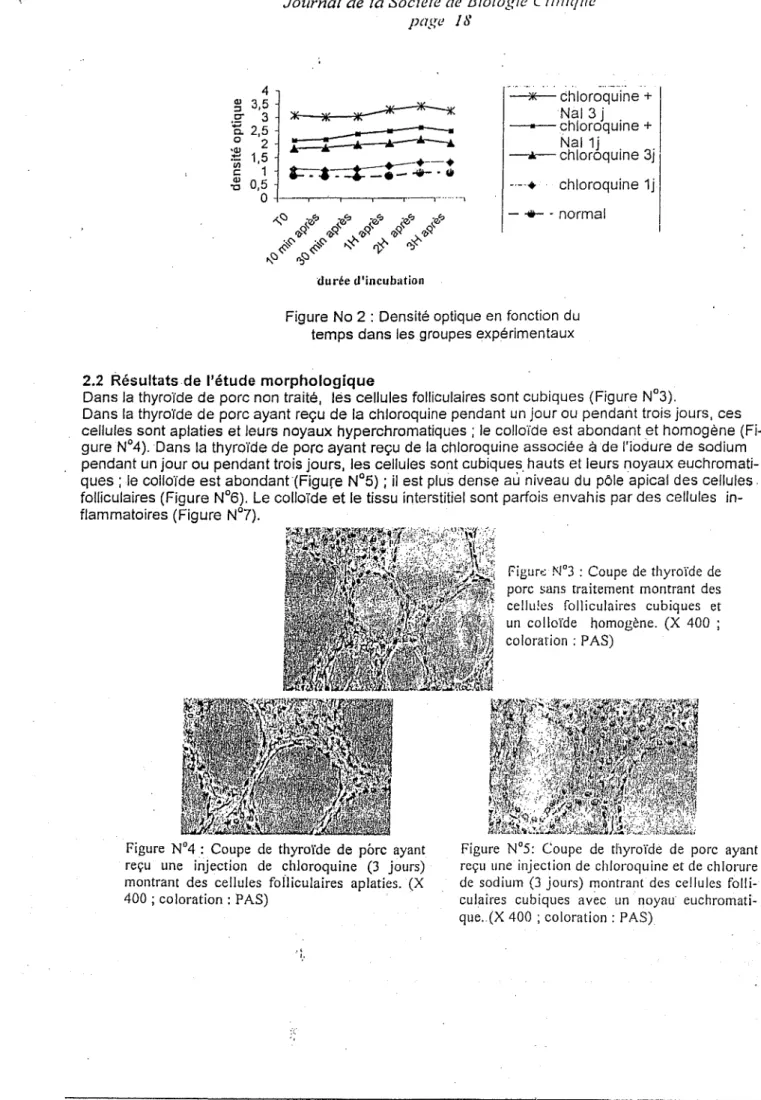 Figure  N°4  :  Coupe  de  thyroîde  de  porc  ayant  reçu  une  injection  de  chloroquine  (3  jours)  montrant  des  cellules  fofliculaires  aplaties