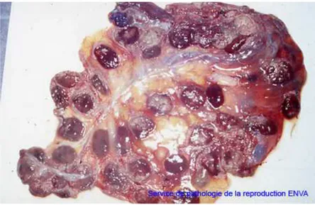 Figure 2 : lésions placentaires 