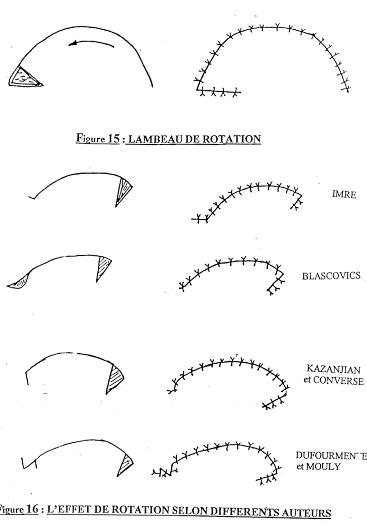 Figure 15 :  LAMBEAU DE ROTATION  IMRE  BLASCOVICS  ,KAZANJIAN  et  CONVERSE  DUFOURMEN~'EL  et  MOULY 