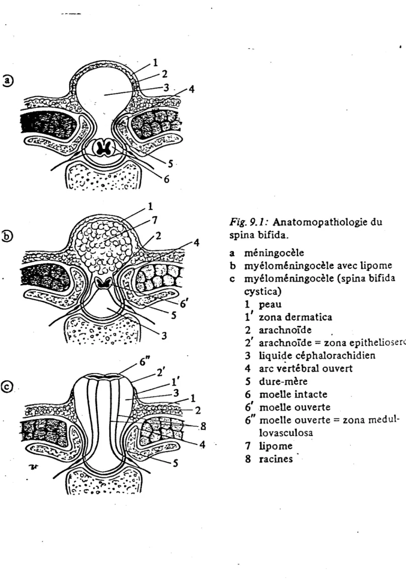 Fig.  9.1:  Anatomopathologie du 