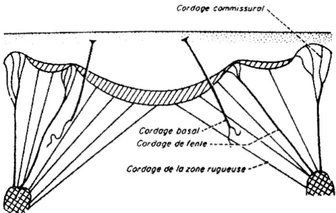 Figure 4 : Cordages de la valve Postérieure (2) 
