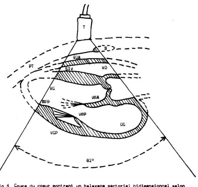 Fig 4 Coupe du coeur montrant un balayage sectoriel bidimensionnel selon le grand axe (Coupe longitudinal)