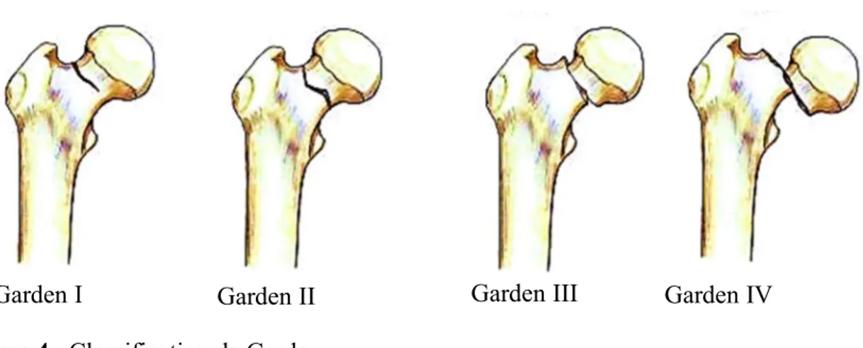 Figure 4 : Classification de Garden .   