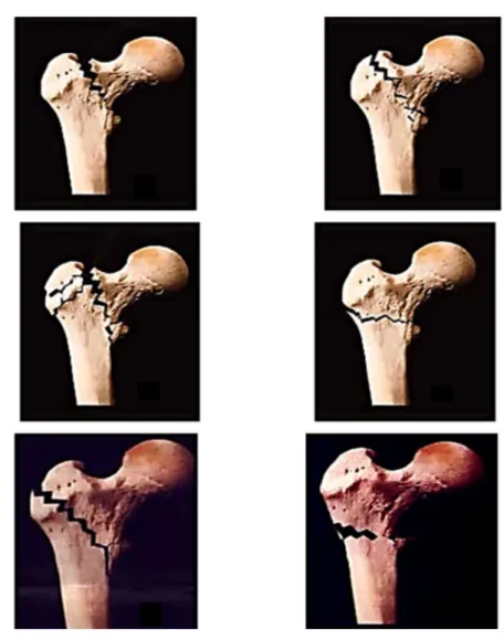 Figure 7 : Classification de Ramadier modifiée par Découlx.   