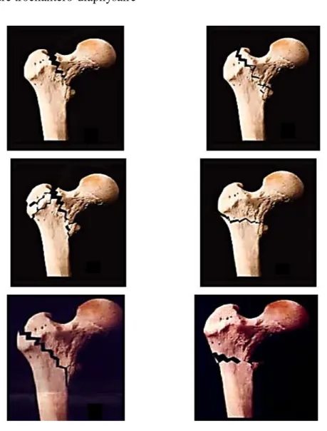 Figure 7 : Classification de Ramadier modifiée par Découlx.   