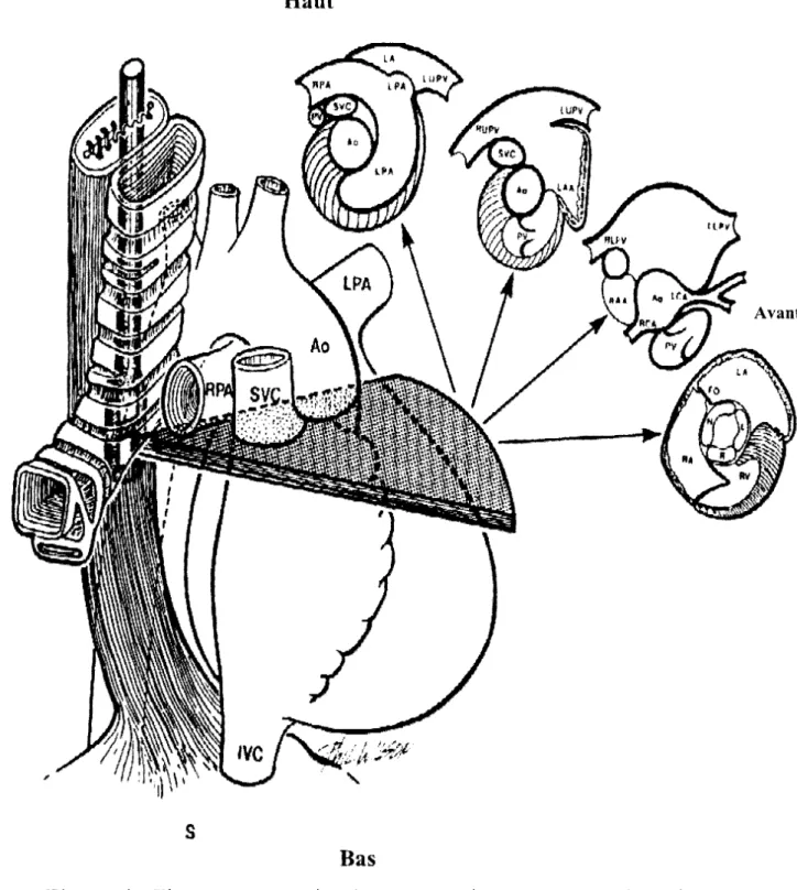 Figure  4:  Figure  montrant  les  4  coupes  petit- axe  pouvant  être  obtenues  par  une vue  horizontale, la sonde étant dans le haut œsophage [ 45] 