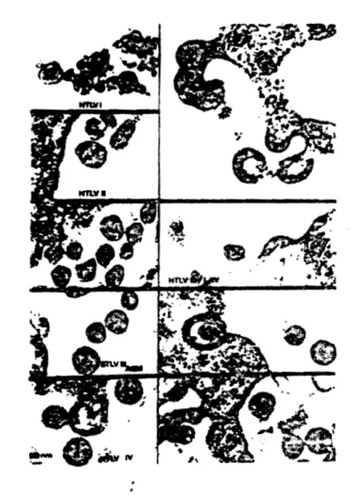 Figure  1:  Aspects  morphologiques  de  quelques  rétrovirus. 