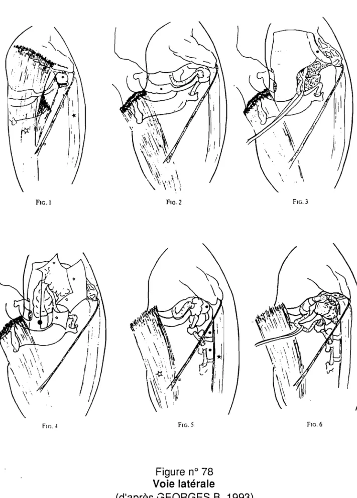 FIG. 1 FIG. 2 FIG.3