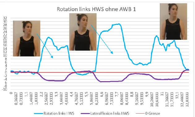 Abbildung A 5:Rotation links HWS ohne AWB 1 