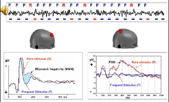 Figure 10. Example of cognitive evoked potentials: the brain can differentiate between what is regular  (F; frequent stimulus), what is rare (R) and what is deviant (mismatch negativity)