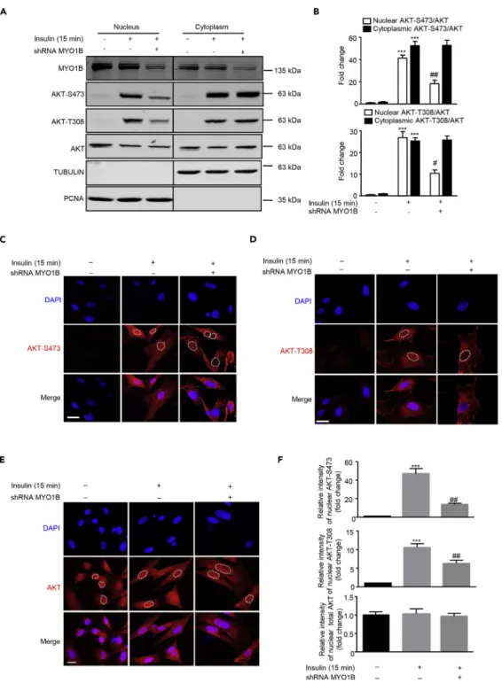 Figure 1. MYO1B Is Required for Insulin-Induced Nuclear AKT Activation