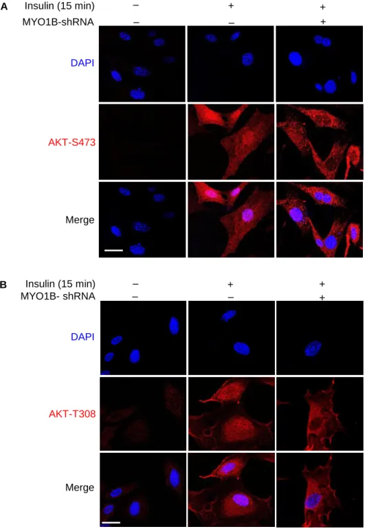 Figure S4. MYO1B is required for insulin-induced nuclear AKT activation. Related to Figure 1C and 1D