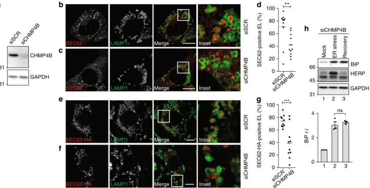 Fig. 5 A role of CHMP4B in recov-ER-phagy. a WB showing knockdown ef ﬁ ciency for siCHMP4B