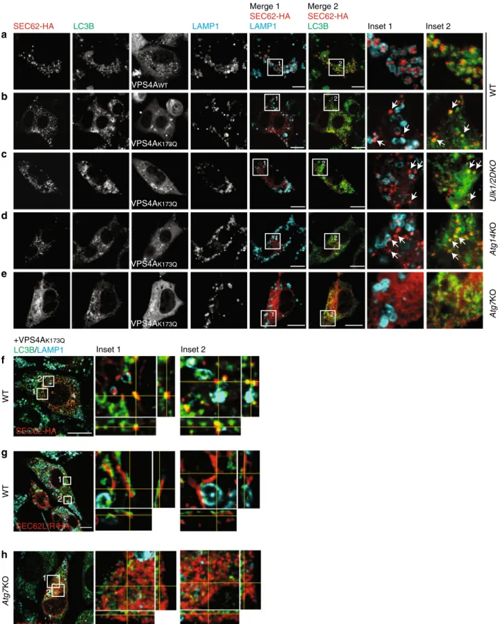 Fig. 8 LC3B localization on SEC62-positive EV. a SEC62-HA co-localizes with endogenous LC3B inside LAMP1-positive EL in WT MEF-expressing VPS4A WT exposed to BafA1 for 12 h