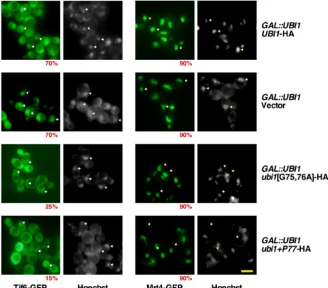 Fig. 8. Expression of the noncleaved Ubi1 precursor impairs cytoplasmic maturation of pre-60S particles