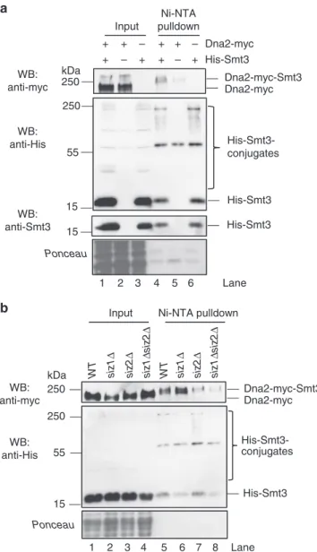 Fig. 1 S. cerevisiae Dna2 is sumoylated in vivo by the Siz2 SUMO ligase.