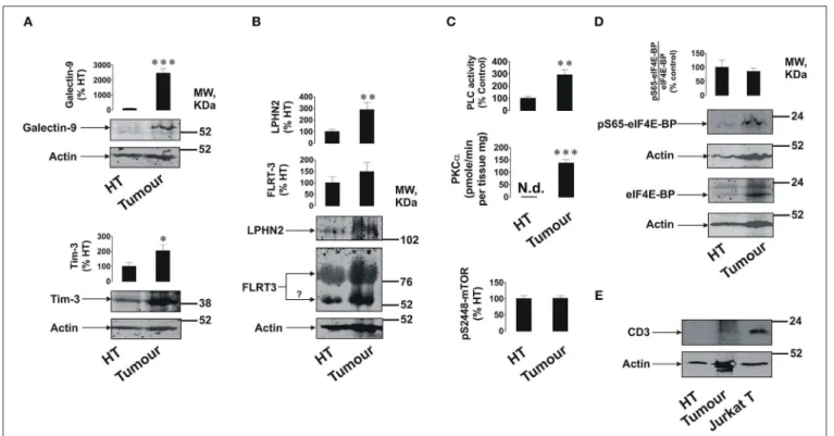 FIGURE 1 | Expression of FLRT3/LPHN/Tim-3/galectin-9 pathway components and activities of PLC/PKCα and mTOR pathways in primary human breast tumors.
