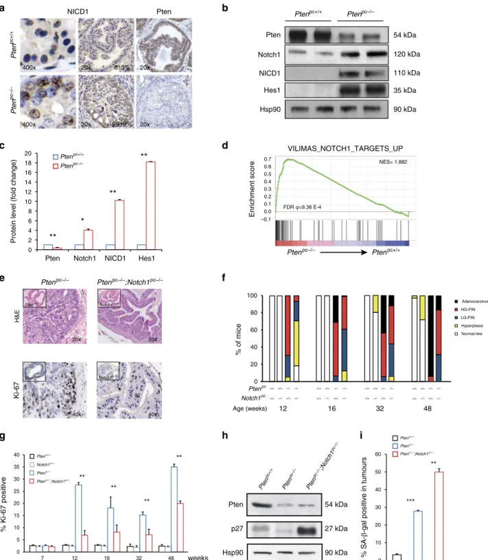 Figure 1 | Notch1 signalling is activated in Pten pc  / prostate tumours. (a) IHC showing NICD1 and Pten stainings in both Pten pc þ / þ normal prostate (8 ± 3%) and Pten pc  / prostatic intraepithelial neoplasia (PIN) lesions resected from 12-week-old mic