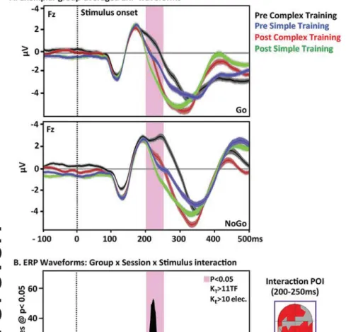 Fig. 4. Electrical neuroimaging analyses: Group ¼ Complex versus Simple; Time ¼ Pre versus Post; Stimulus ¼ Go versus NoGo