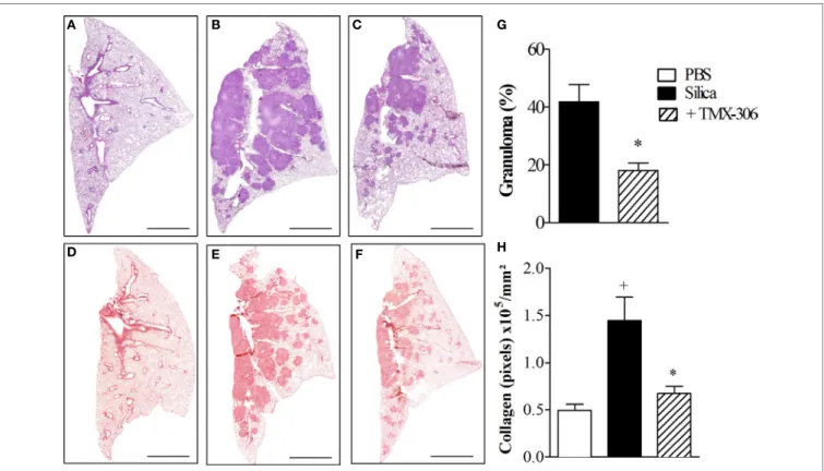 FigUre 9 | effect of intranasal treatment with TMX-306 on granuloma formation (upper panels) and collagen deposition (lower panels) in   