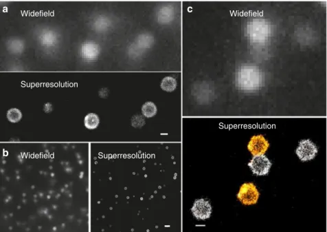 Fig. 2 Two-color dSTORM superresolution microscopy of microgel pairs. Examples for dye-labeled tracer particles seeded in densely packed microgel suspensions are shown ( T = 22 °C) 37 