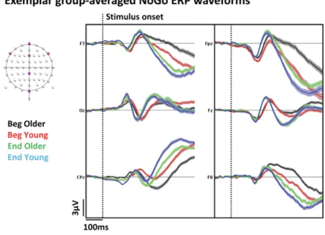 Fig. 3. Electrical neuroimaging analyses in the sensor space of the interaction between the factors Group (Older; Young) and Session (Beginning; End of the practice)