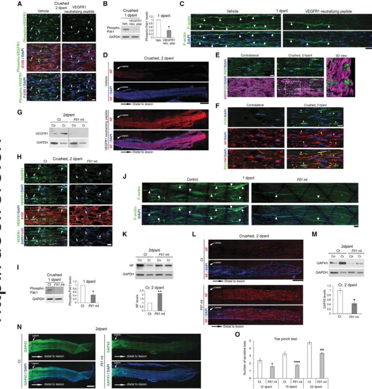 Figure 6. Speciﬁc Inactivation or Genetic Ablation of VEGFR1 Impairs Distal Cut Axon Disintegration after Sciatic Nerve Crush Lesion (A) Phospho-VEGFR1, S100 (SC marker), and F4/80 (macrophage marker) co-immunoﬂuorescence and DAPI (nuclei) labeling at 2 dp