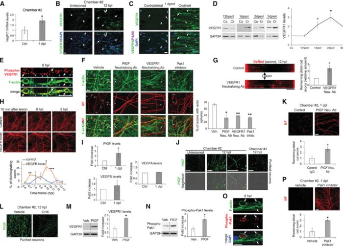 Figure 5. Axonal PlGF Activates VEGFR1-Dependent Actin Dynamics in SCs, Leading to Distal Cut Axon Fragmentation (A) Vegfr1 mRNA levels quantiﬁed by qRT-PCR in SCs (chamber 2) showing increased levels at 1dpl compared with unlesioned conditions (Ctrl).