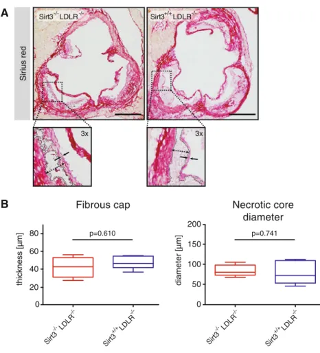 Fig. 2 Deletion of Sirt3 does not affect features of plaque stability. Sirt3 -/- LDLR -/- and Sirt3 ?/? LDLR -/- mice were treated as described and aortae excised