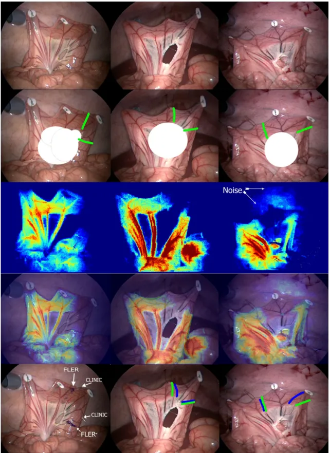Fig. 1 Fluorescence-based Enhanced Reality after 2, 4, and 6 h of ischemia .First row 3 bowel loops were exposed and an ischemic segment was created, sealing some mesenteric vessels by means of the LigaSure TM vessel-sealing device