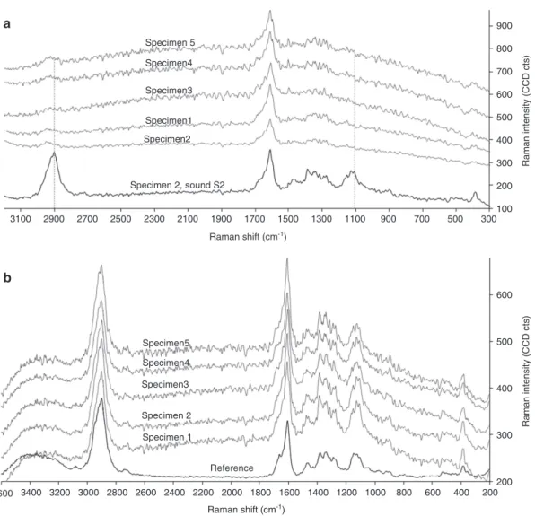 Figure 4 Average Raman spectra of (a) residual material (RM) and of (b) sound S2 in waterlogged archaeological spruce in five different  specimens (grey lines) compared to a spectrum of either sound S2 (a) or S2 in reference (b) (black lines)