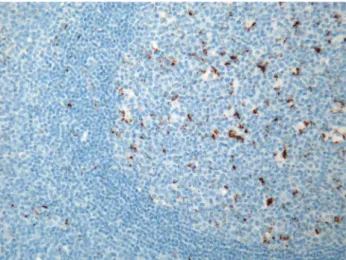 Fig. 4 Human tonsil stained with the anti-PD-L1 antibody clone ab58810, demonstrating strong granular cytoplasmic staining of the follicular dendritic cells and the absence of staining in the  surround-ing lymphocytes
