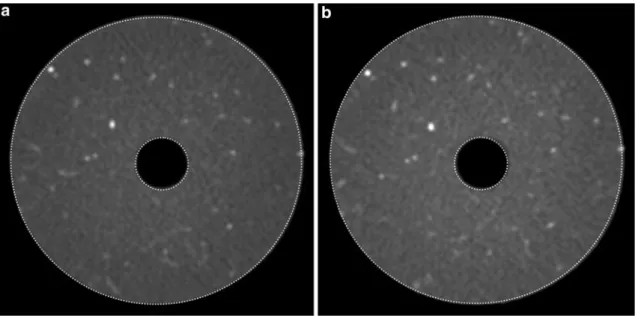 Fig. 8 Medium resolution X-ray scans of Boom clay N14 sample cored perpendicular to bedding, carried out through the testing cell before (a) and after (b) the occurrence of a leakage between the inner