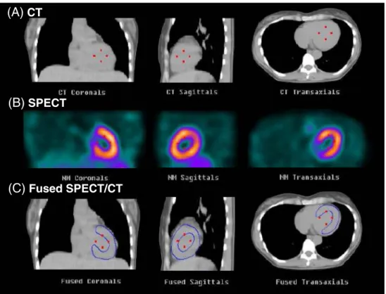 Fig. 5 Coregistration of low- low-dose CT (a) and SPECT (b) for attenuation correction of myocardial perfusion SPECT.