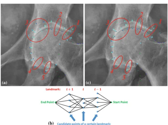Fig. 6 a Examples show that the minimal Mahalanobis distance may not be a sufficient criterion for choosing the suggested points for  land-marks in the femoral head region (enclosed by red ellipses)