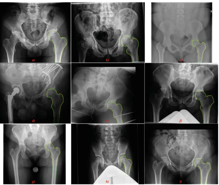 Fig. 9 Examples of the interesting segmentation results (ground truth: