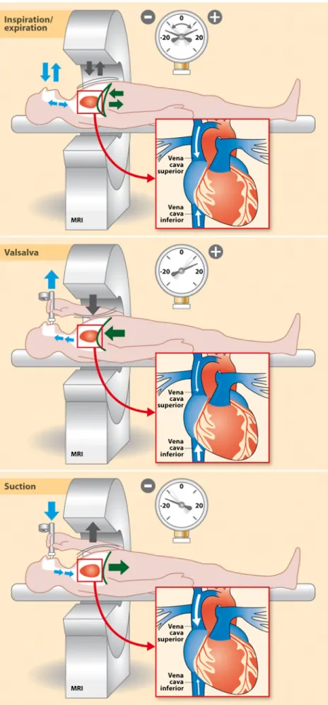 Fig. 3 The complete experimental set-up including physiology is shown here. During free breathing, the diaphragm rises and falls