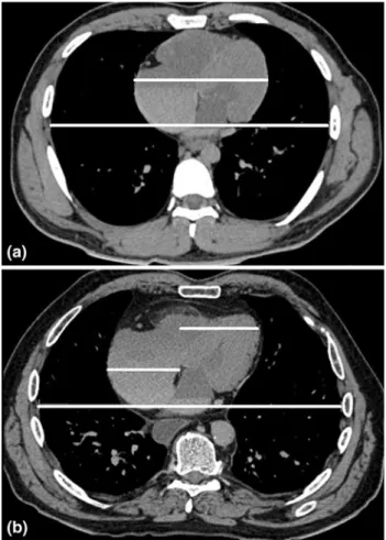 Table 2 Results for heart weight, CTR, and diagnosis of cardiomegaly