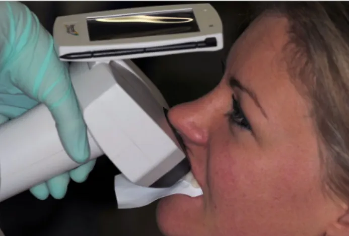 Fig. 1 Clinical use of spectrophotometer employed in this study