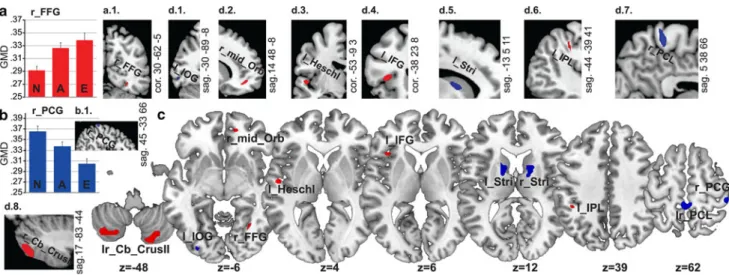 Fig. 2 Brain clusters with significant positive (red) and negative (blue) effects of expertise on GMD (p \ 0.001, unc., k = 30; only for l_Heschl p \0.005, unc., k = 30)