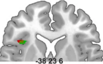 Fig. 3 Overlap of functional results (in green; interaction exper- exper-tise 9 transgression) from Oechslin et al