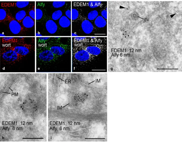 Fig. 5   eDeM1 colocalizes with the selective autophagy cargo recep- recep-tor alfy and becomes engulfed by isolation membranes